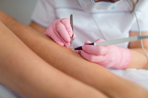 Épilateur définitif à lumière pulsée made in france : efficacité prouvée